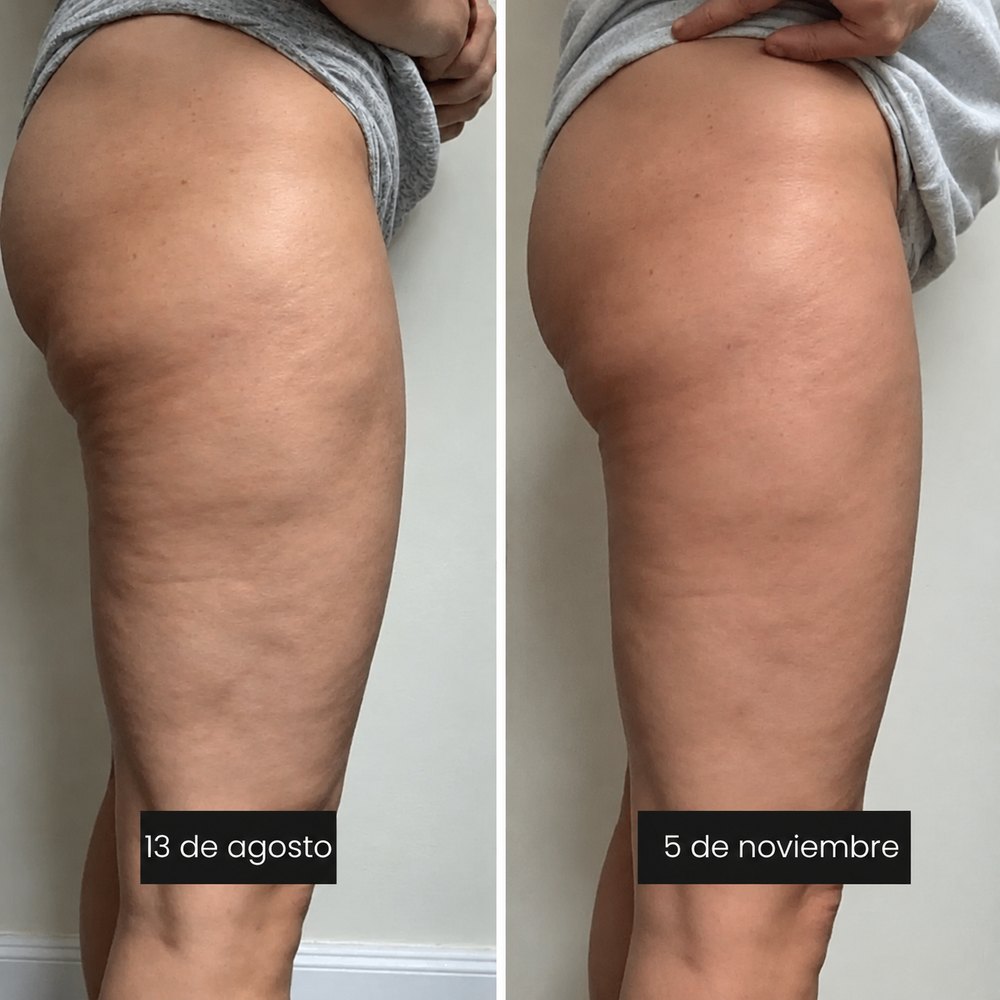 Antes y después: Isabel R.