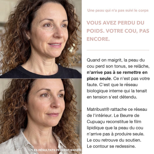 Crème Cou Liftante & Raffermissante BioChroma