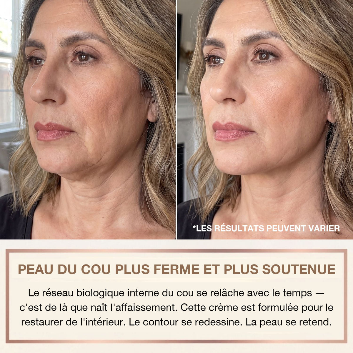 Crème Cou Liftante & Raffermissante BioChroma