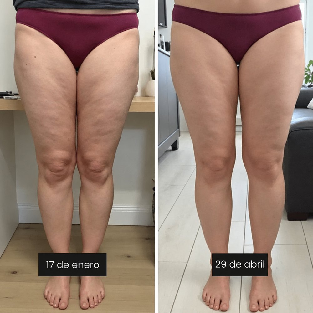 Antes y después: Tamara G.