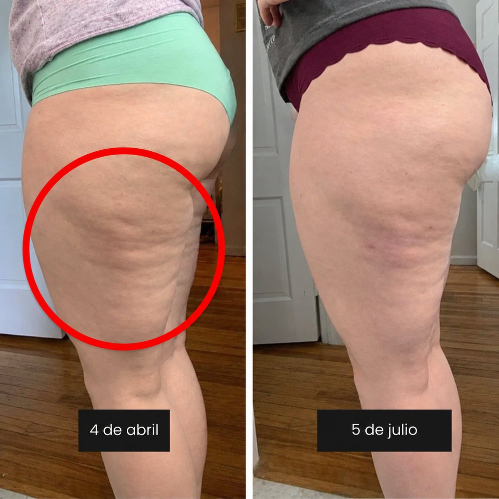 Antes y después: Sofía M.