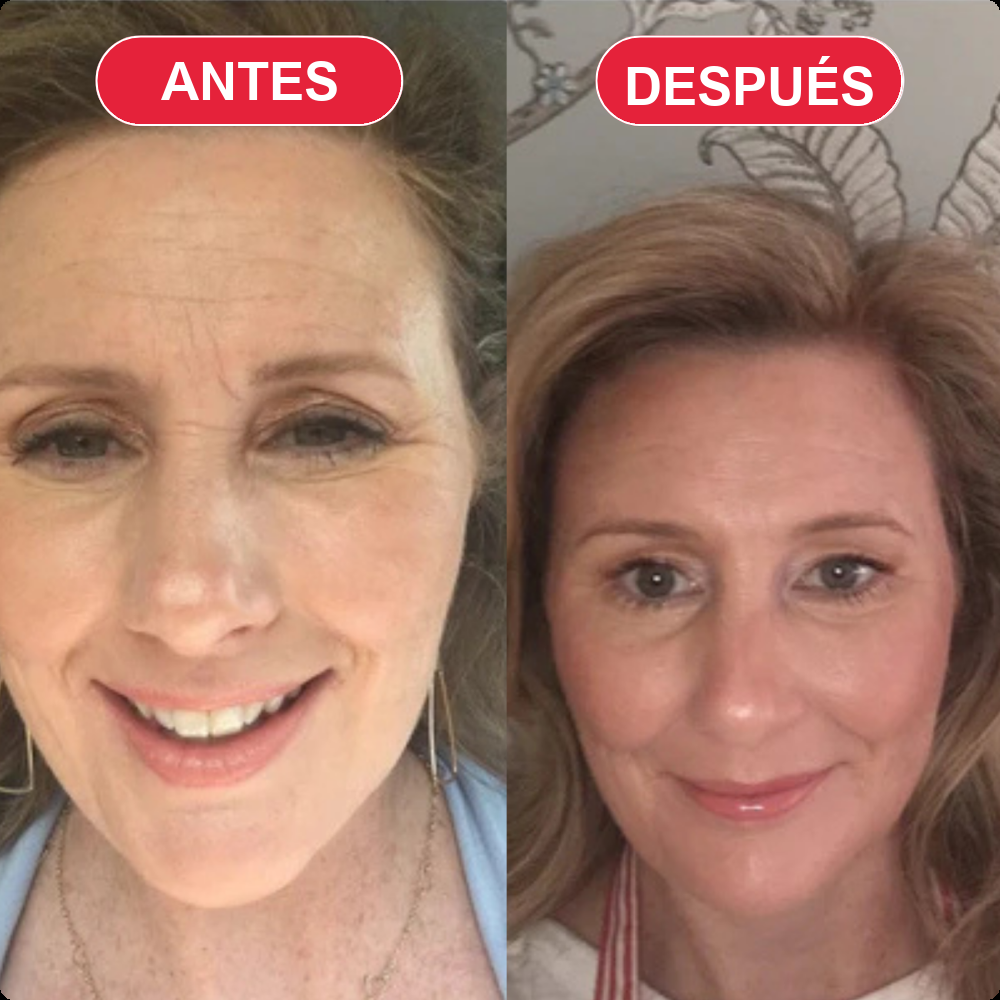 Antes y después