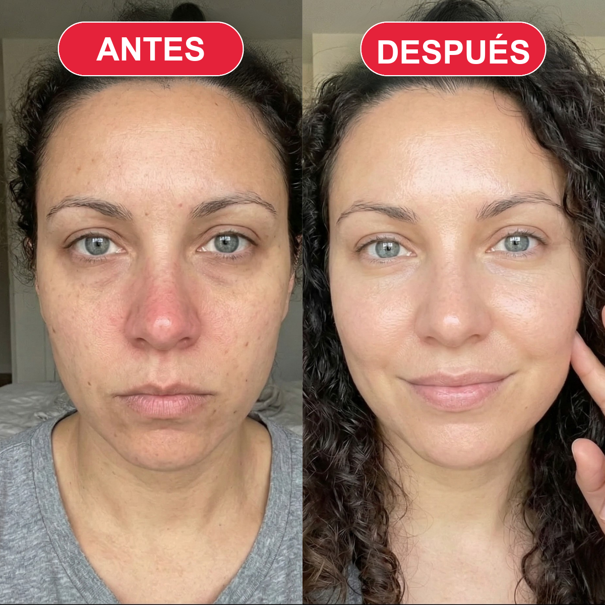 Antes y después