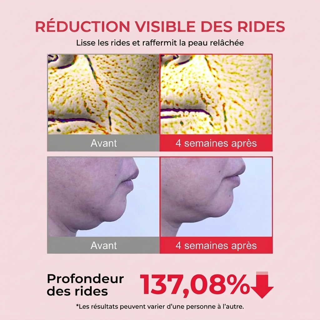 Réduction visible des rides